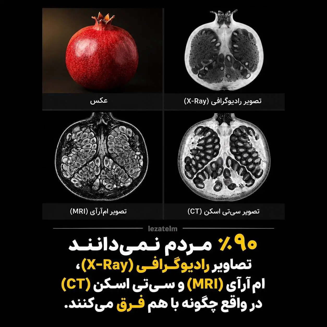 تفاوت تصاویر رادیوگرافی و ام آر آی و سی تی اسکن به روایت تصویرهایشان 