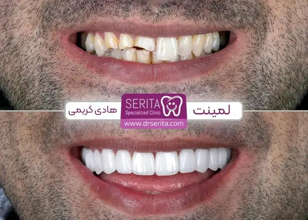 دندانپزشکی اقساطی با کلینیک سریتا