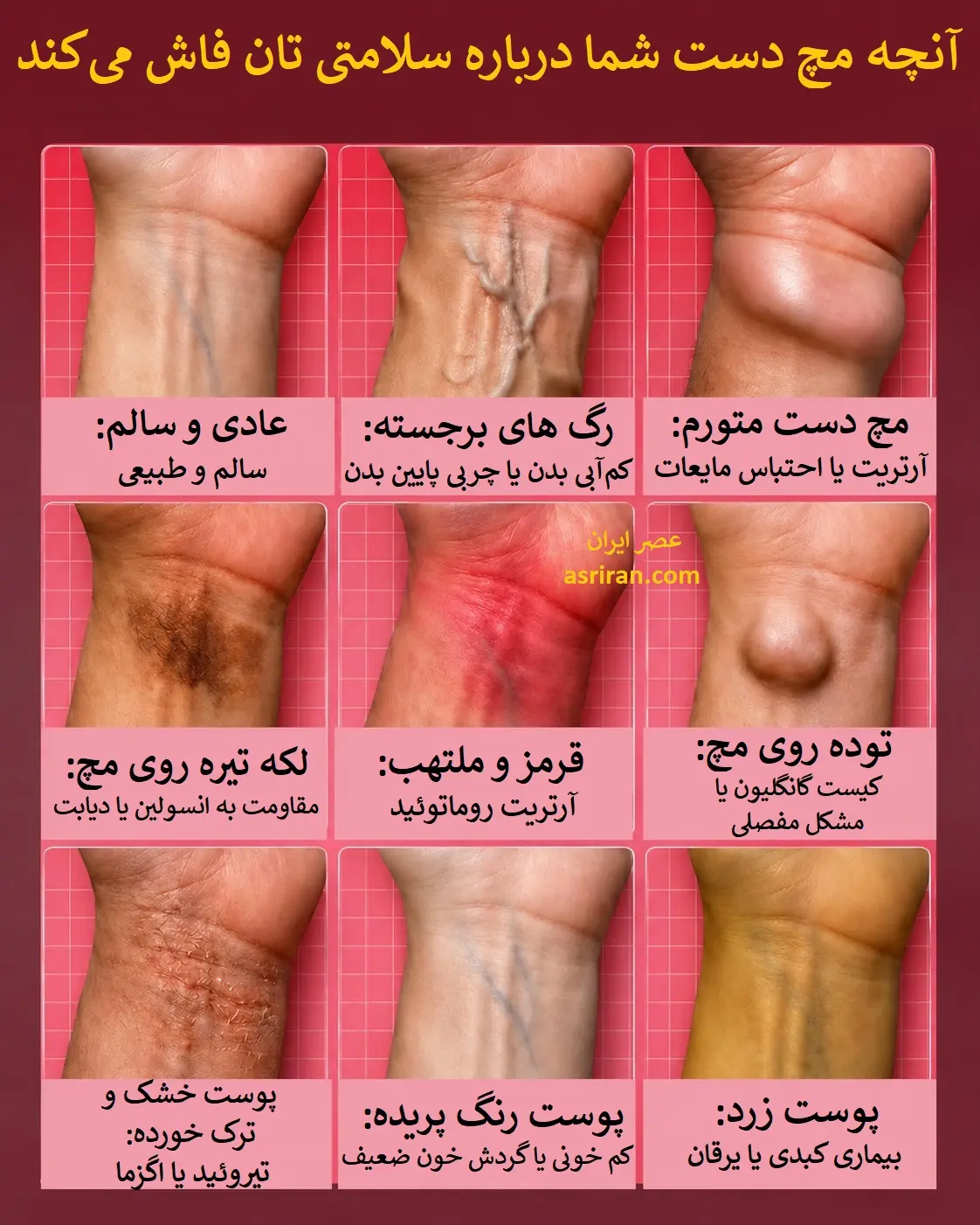 رازهایی که مچ دست درباره سلامت شما فاش میکند!