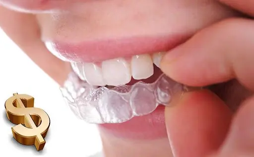 چطور هزینه ارتودنسی را کاهش دهیم؟