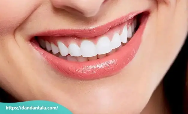 اصلاح طرح لبخند با لمینت یا کامپوزیت کدام یک بهتر است؟