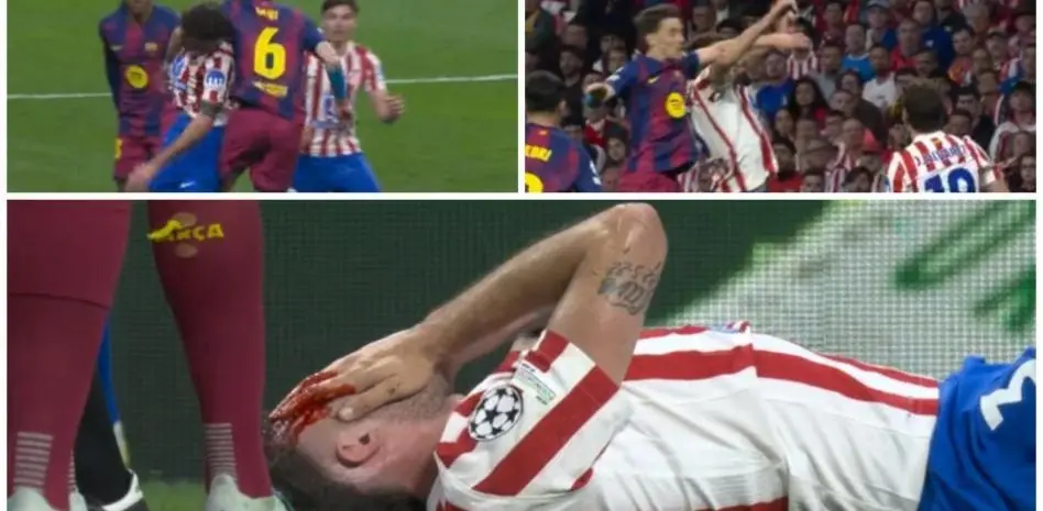 صحنه‌ای جنجالی که متروپولیتانو را شعله‌ور کرد