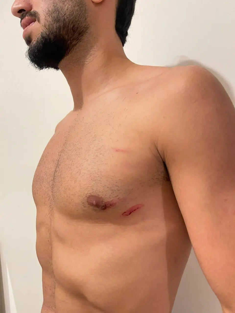 آسیبدیدگی محمد شریفی در برخورد شدید با سروش رفیعی