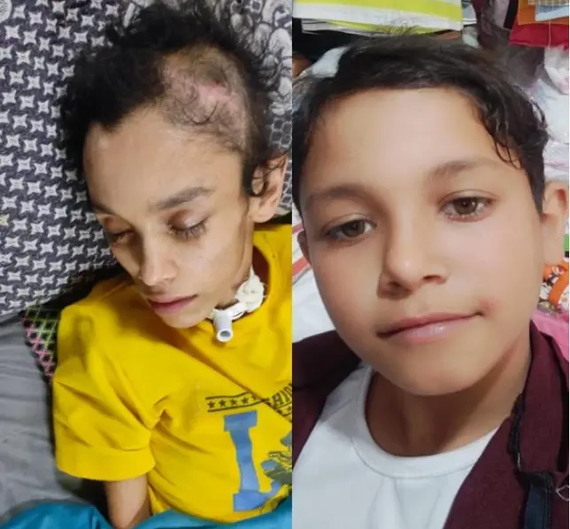 چهره‌های گرسنه غزه؛ دو سال قحطی و محاصره در قاب تصاویر