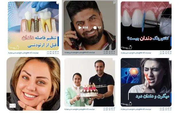 پیج اینستاگرام 5  بهترین "دکترهای کامپوزیت دندان در تهران"