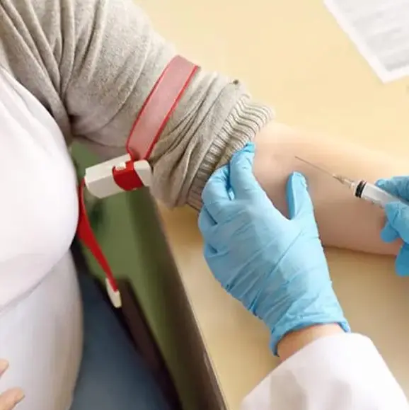 بهترین آزمایشگاه در تهران چه آزمایشاتی را تحت پوشش قرار می دهد؟