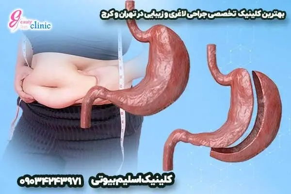 دقت و ایمنی بیشتر با حضور دو جراح همزمان در هر عمل لاغری 