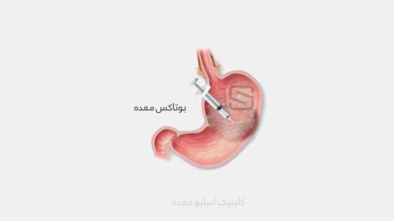 آشنایی با 2 روش لاغری مدرن + 2 روش منسوخ شده