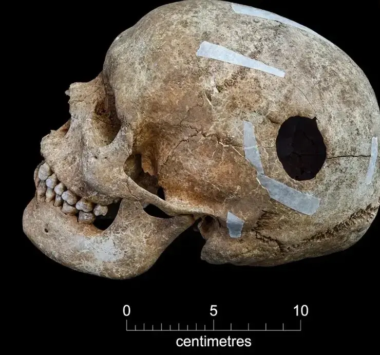 گودال ترسناک پر از اسکلت در یک مزرعه