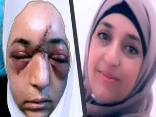 سربازان اسرائیل این گونه جمجمه میشکند+عکس