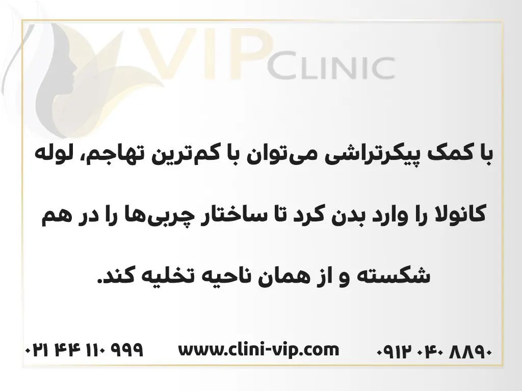 بهترین روش برای پیکرتراشی شکم و پهلو چیست؟ چطور در یک روز لاغر شویم؟