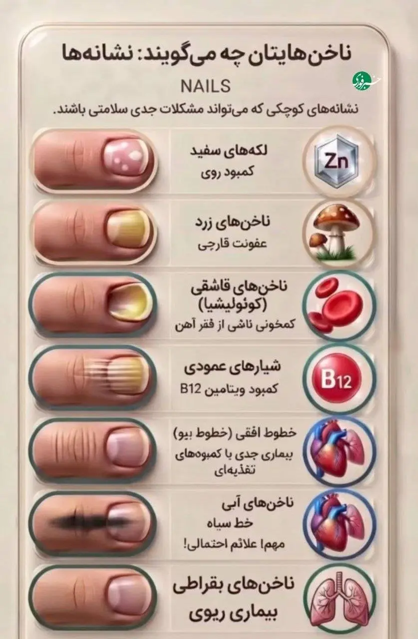  ناخن‌ها صحبت می‌کنند؛ نشانه‌ها را دست‌کم نگیر!
