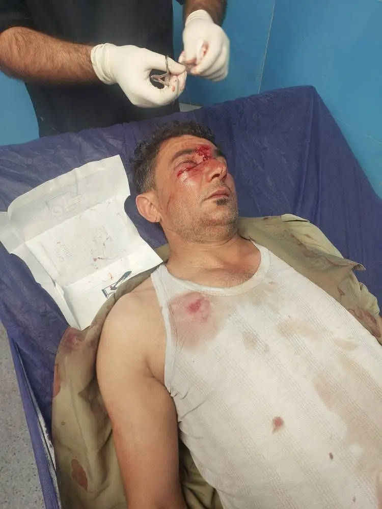 دو محیطبان پارک ملی کرخه در درگیری با متخلفان شکار غیرمجاز مصدوم شدند