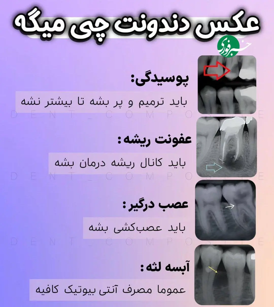 تشخیص مشکلات دندان از روی عکس + اینفوگرافیک