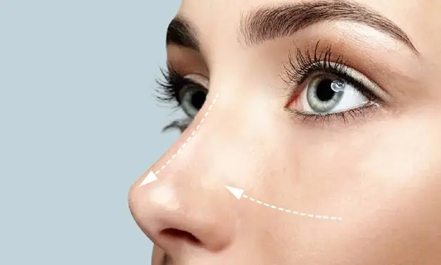 جراحی بینی در ایلام؛ راز چهره‌ای جذاب و زیبا