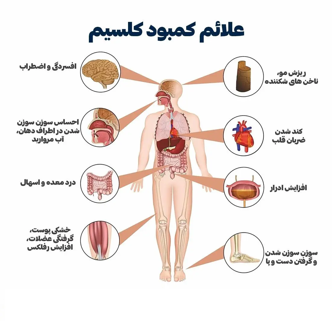 علائم کمبود کلسیم را در بدن بشناسیم + اینفوگرافیک