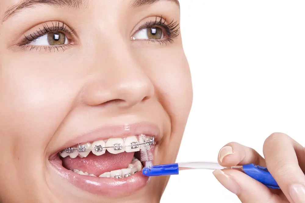 چرا ارتودنسی ثابت کارآمدترین و ارزان‌ترین روش ارتودنسی است؟
