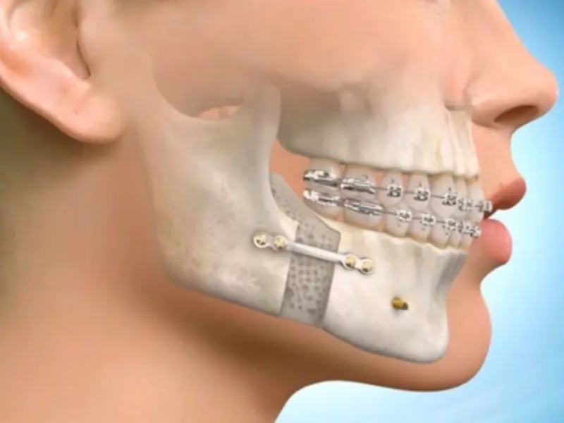 متخصص ارتودنسی همان دندانپزشک نیست!