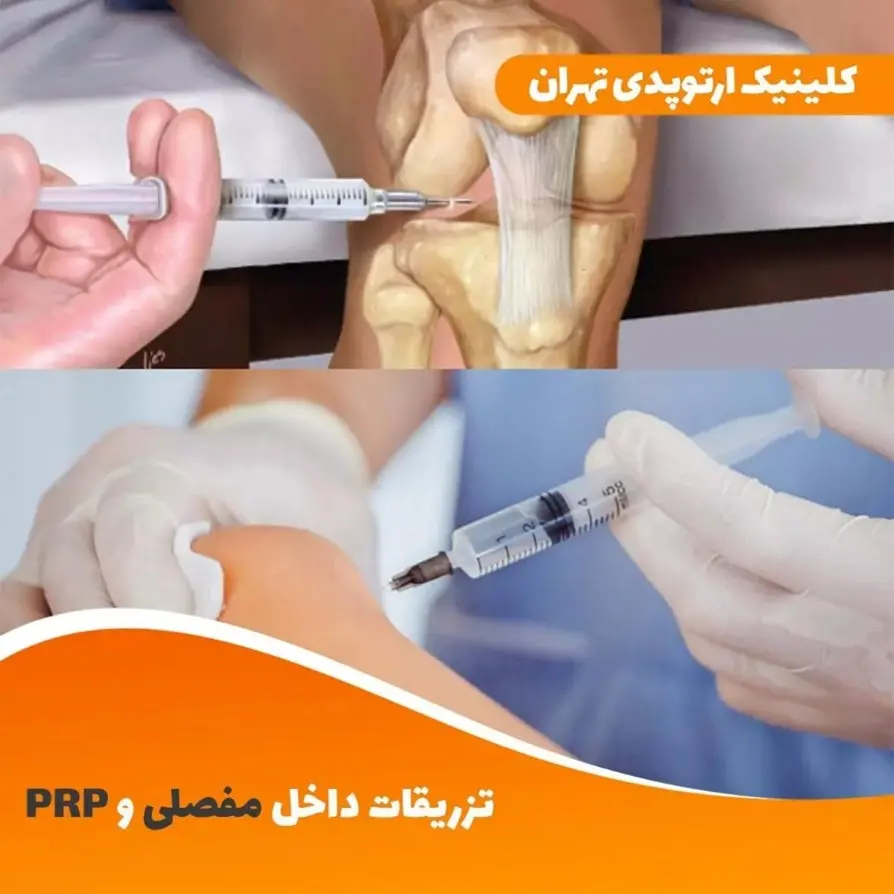 بهترین روش های درمان آرتروز و آسیب های ورزشی