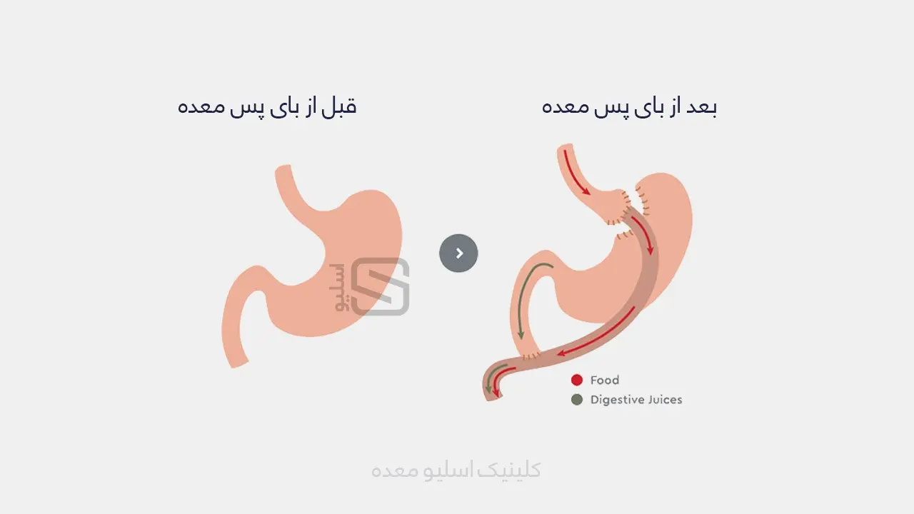 آشنایی با 2 روش لاغری مدرن + 2 روش منسوخ شده