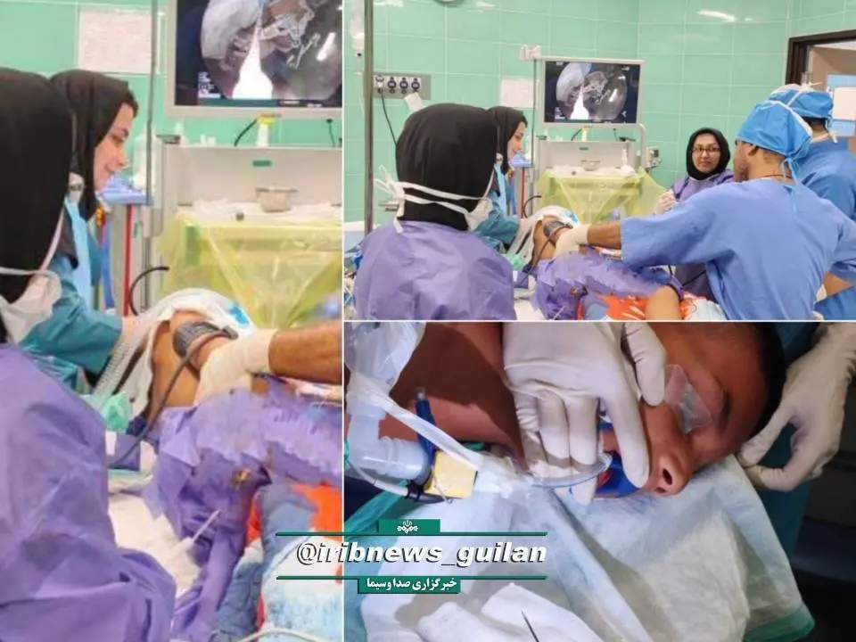 خارج کردن سوزن از روده کودک ۱۰ ساله در رشت+ عکس