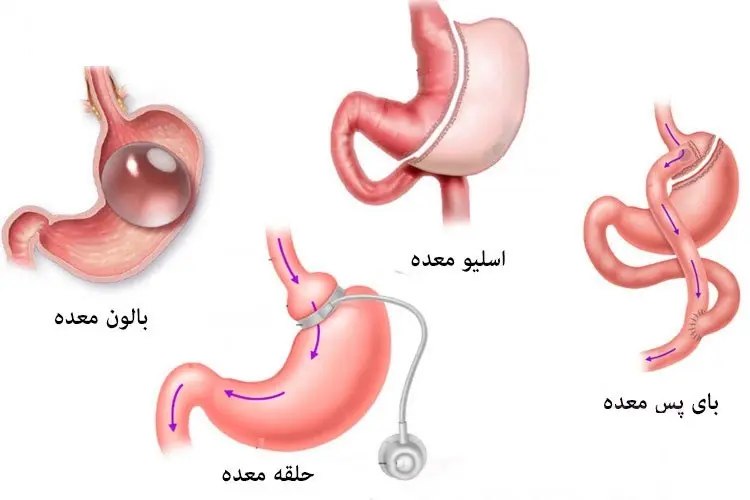 آشنایی با دکتر عبدالله زندی جراح لاغری و چاقی