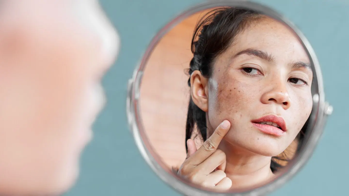 مشاوره آنلاین برای درمان اثرات تیروئید بر پوست