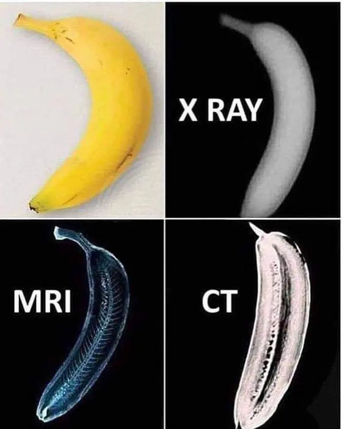 کدام تصویر دقیق‌تر است؟ مقایسه اشعه ایکس، ام‌ آر‌ آی و سی‌ تی‌ اسکن با تصویر یک موز