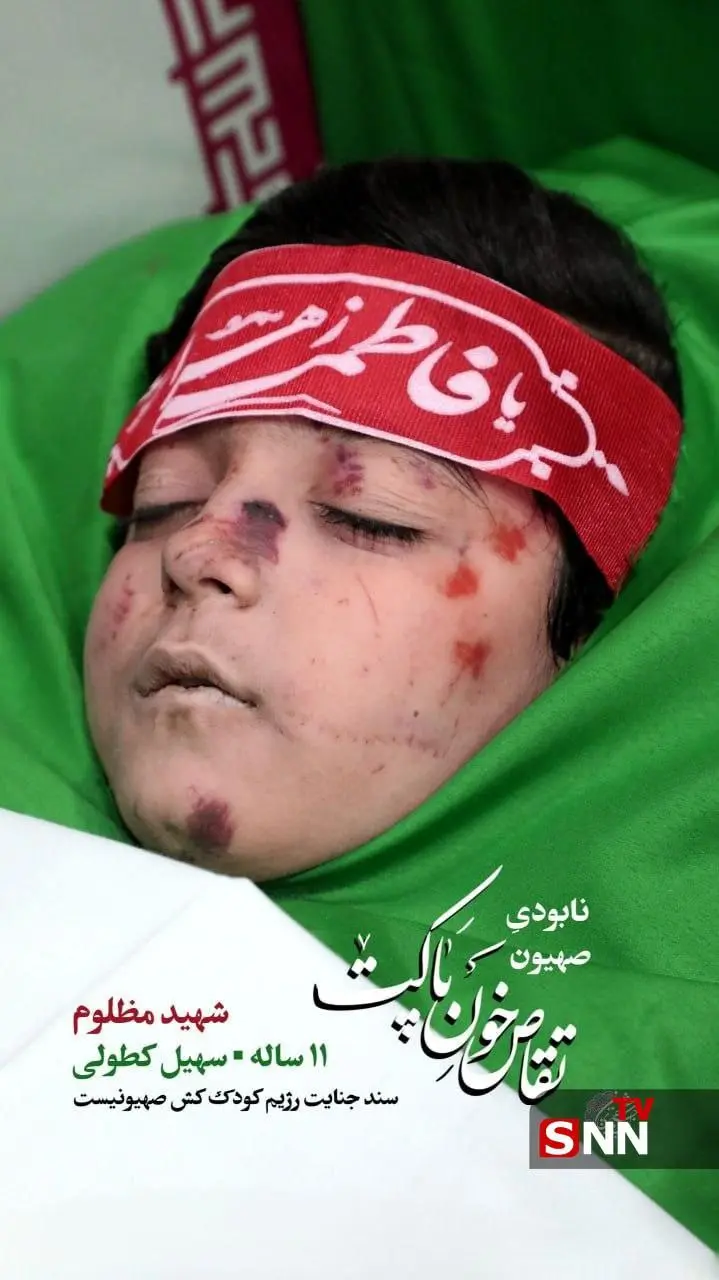 تصویر پیکر مطهر شهید مظلوم سهیل کطولی