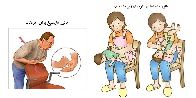 اگر تنها بودید، چطور خودتان را از خفگی نجات دهید؟ + آموزش تصویری