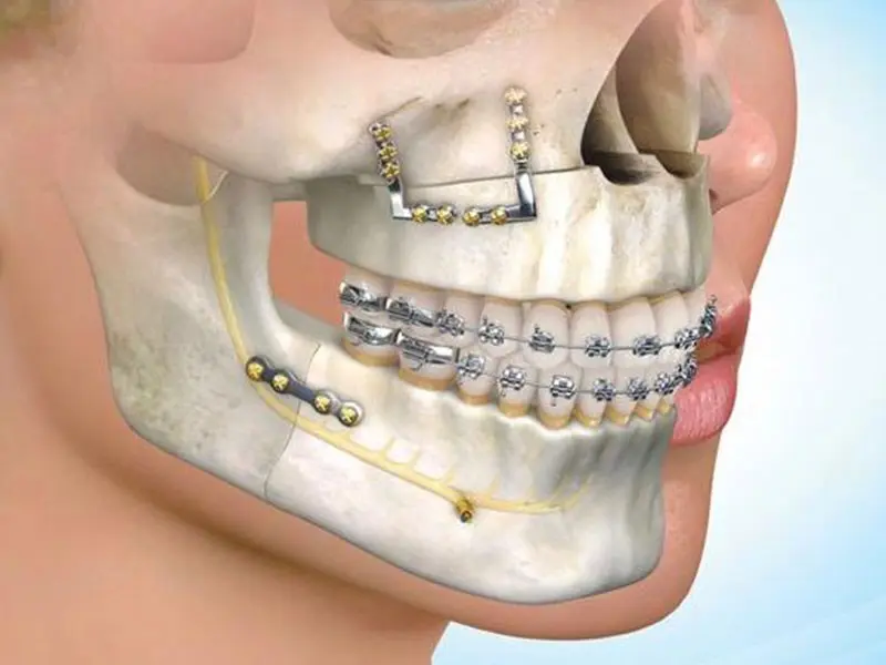 متخصص ارتودنسی همان دندانپزشک نیست!