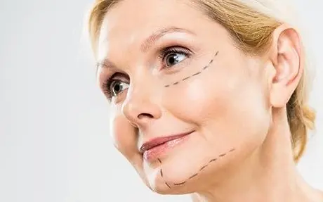 افتادگی پوست صورت، راه‌های درمان شل شدن پوست صورت