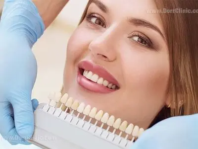 بررسی لمینت، بلیچینگ و ایمپلنت دندان سه نوع از مهم‌ترین خدمات دندان‌پزشکی