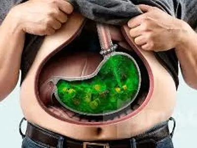 راه های کوچک کردن معده بدون جراحی