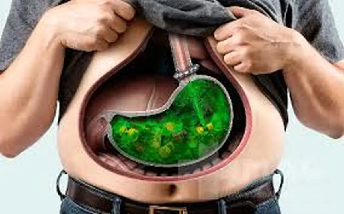 راه های کوچک کردن معده بدون جراحی