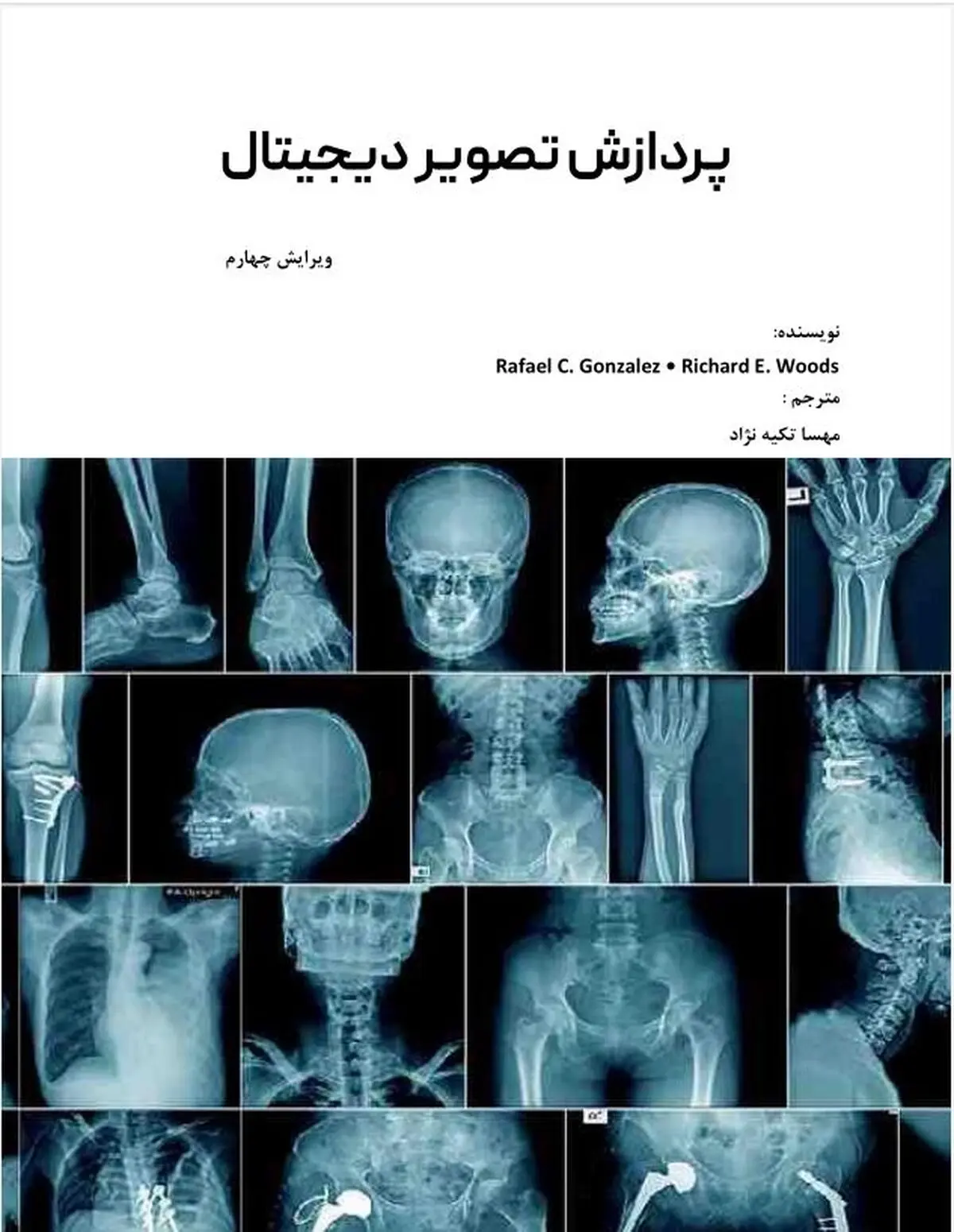دانلود کتاب پردازش تصویر دیجیتال گنزالس ترجمه فارسی (ویرایش جدید )