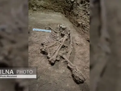 کشف قدیمی‌ترین قطع عضو در دوران ماقبل تاریخ