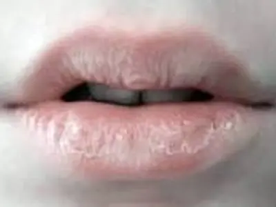 asdasd