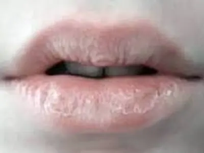 اگر این علائم را دارید از رژ لب استفاده نکنید