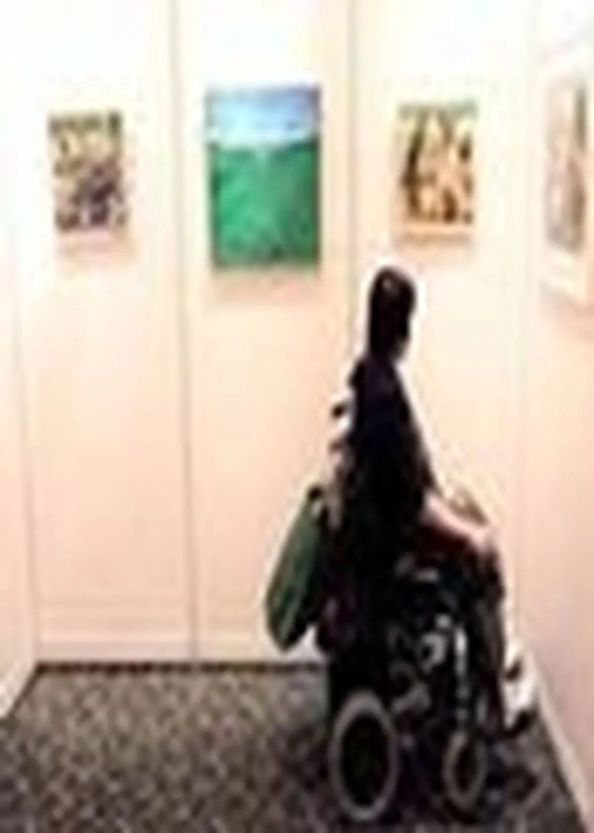 او برای درمان لگن شکسته اش ۳۰ میلیون تومان نیاز دارد / حسین با ۳۰۰ هزارتومان زندگی را شرمنده کرده؟!