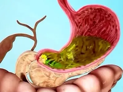 asdasd