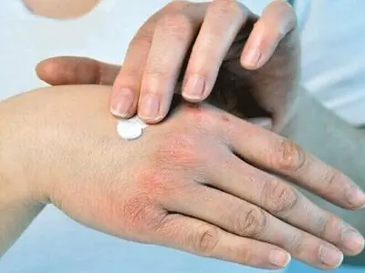 هفت راهکار خانگی برای خشکی پوست 