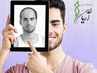 بررسی مهم ترین و تاثرگذار ترین روش ها کاشت مو و ابرو