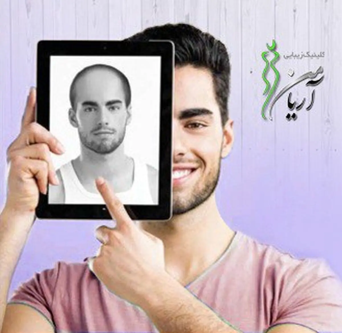بررسی مهم ترین و تاثرگذار ترین روش ها کاشت مو و ابرو