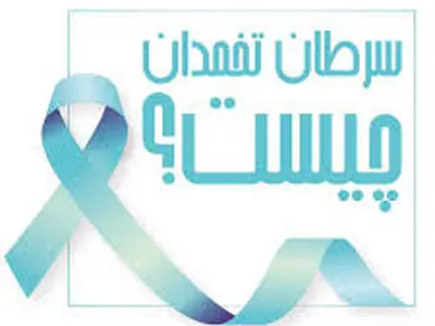 توصیه‌هایی برای کاهش خطر ابتلا به سرطان تخمدان + اینفوگرافیک