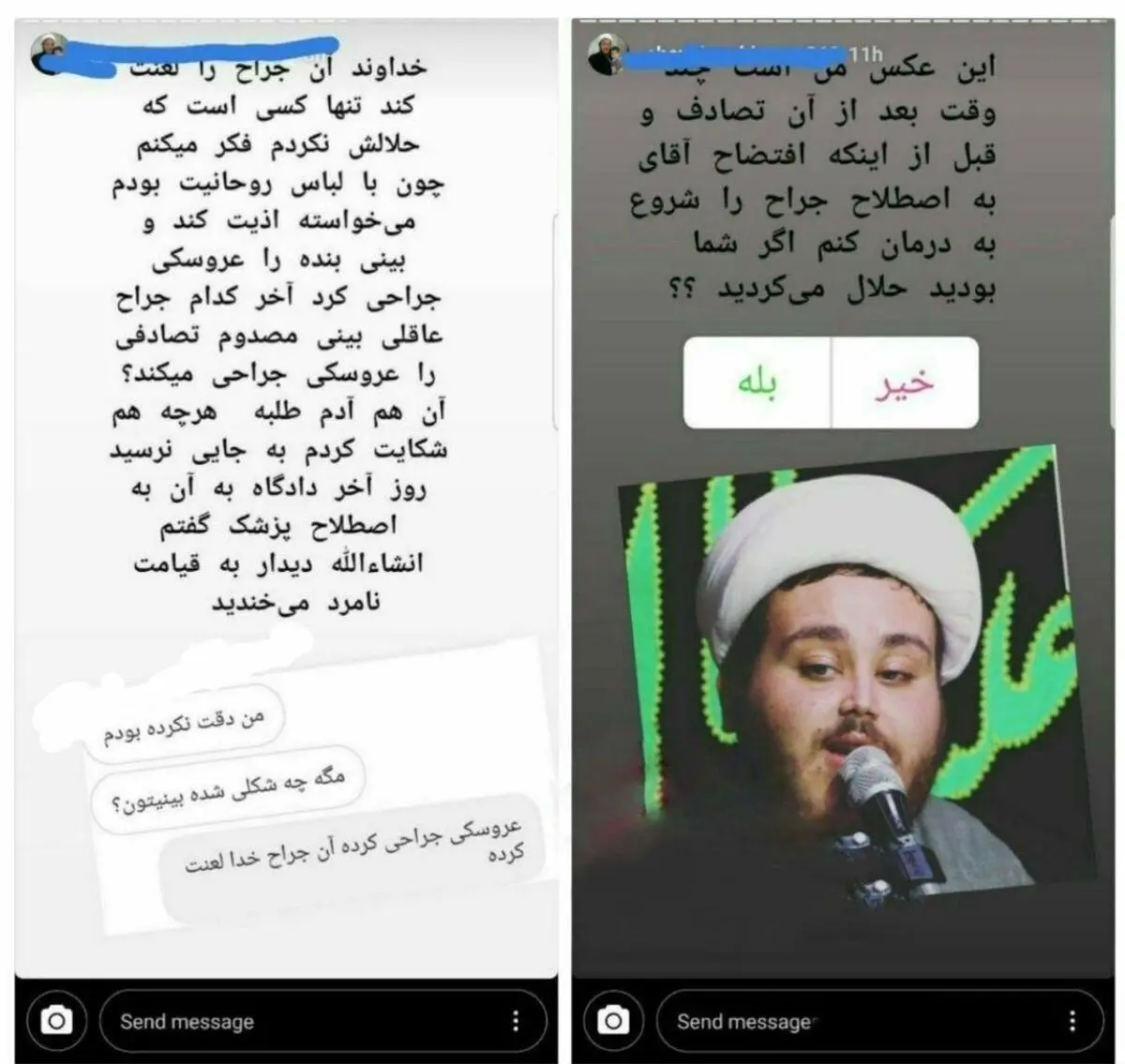 روحانی که به خاطر «بینی عروسکی‌اش» شکایت کرد+عکس