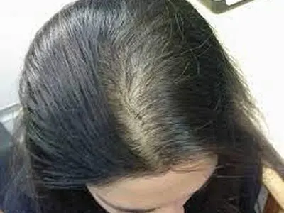 ساده‌ترین راهکار خانگی برای پرپشت شدن موهای نازک