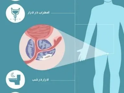۱۱ ژوئن روز جهانی سرطان پروستات است