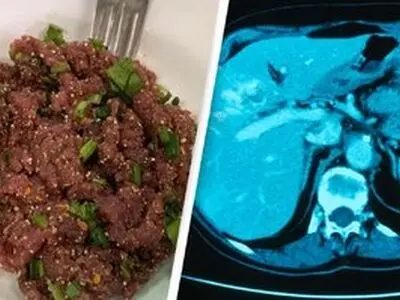 مرگ‌بارترین غذای دنیا