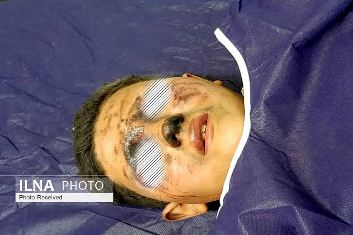 سوختگی مادر و فرزند در سانحه ساخت ترقه دست ساز